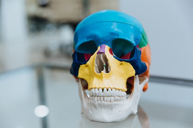 Startup fabrica el implante craneal por tecnología de impresión 3D